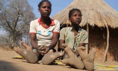 Zimbabwe : les Vadoma, la tribu aux pieds d’autruche, intrigue la science