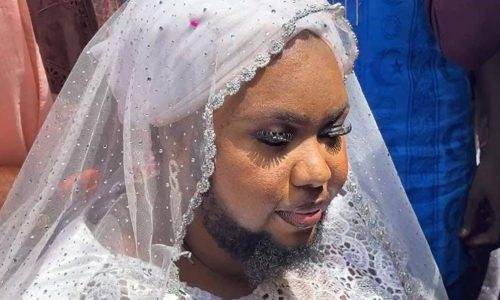 Mali : Aïcha Kanté, la femme barbue, trouve l’amour et se marie