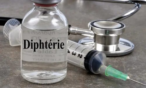 248 cas de diphtérie confirmés dans 13 régions
