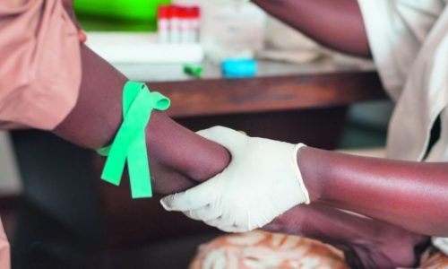 Sénégal : Les chiffres réels sur le VIH/Sida parmi les femmes et les hommes selon les spécialistes